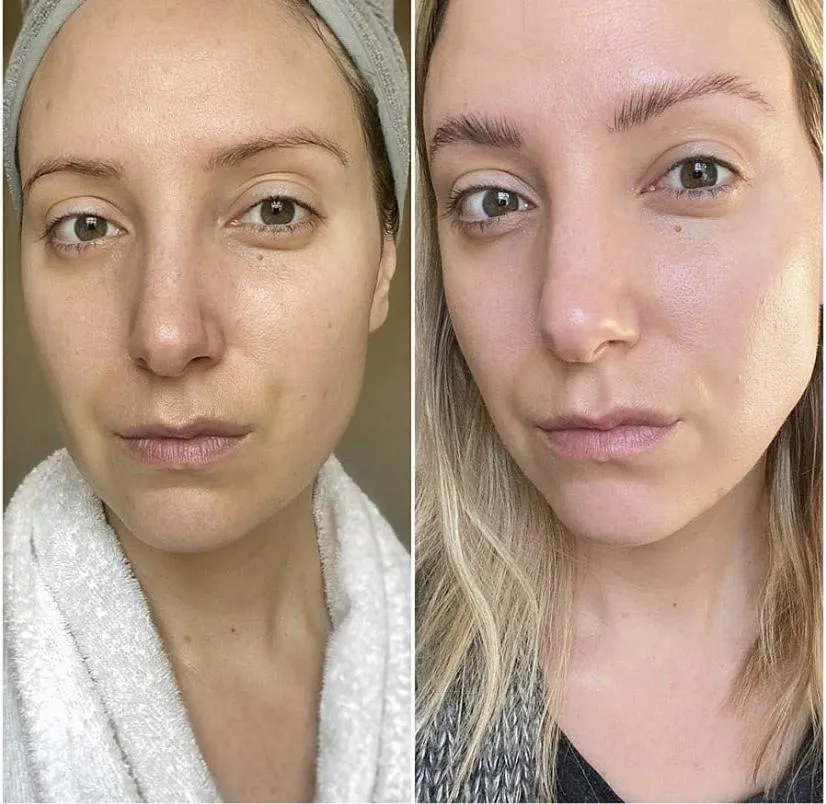 THE STRAIGHT A SERUM – Advanced Gentle Retinol Treatment